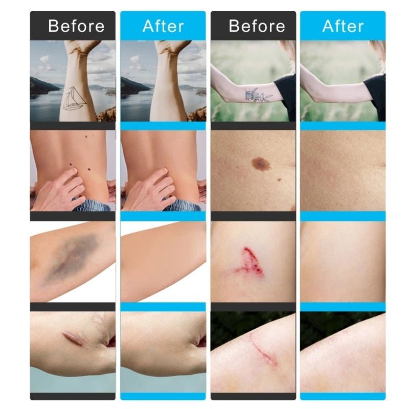 Waterproof Cover Up Patches/6Pcs - LightsBetter
