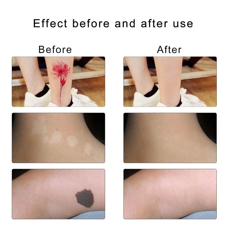 Waterproof Cover Up Patches/6Pcs - LightsBetter