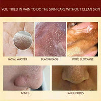 Thumbnail for Herbal Peel-Off Mask - LightsBetter