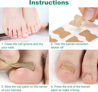 Thumbnail for Ingrown Nail Corrector - LightsBetter