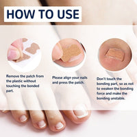 Thumbnail for Ingrown Nail Corrector - LightsBetter