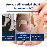 Thumbnail for Ingrown Nail Corrector - LightsBetter