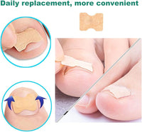Thumbnail for Ingrown Nail Corrector - LightsBetter