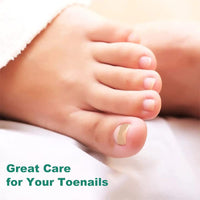 Thumbnail for Ingrown Nail Corrector - LightsBetter