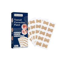 Thumbnail for Ingrown Nail Corrector - LightsBetter