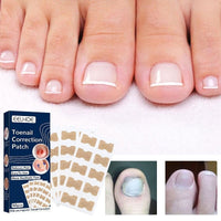 Thumbnail for Ingrown Nail Corrector - LightsBetter