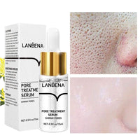 Thumbnail for LANBENA Blackhead Remover Cream - LightsBetter