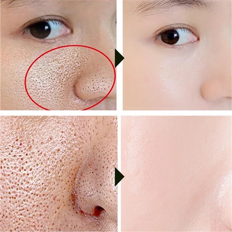 Magical Pore Eraser - LightsBetter