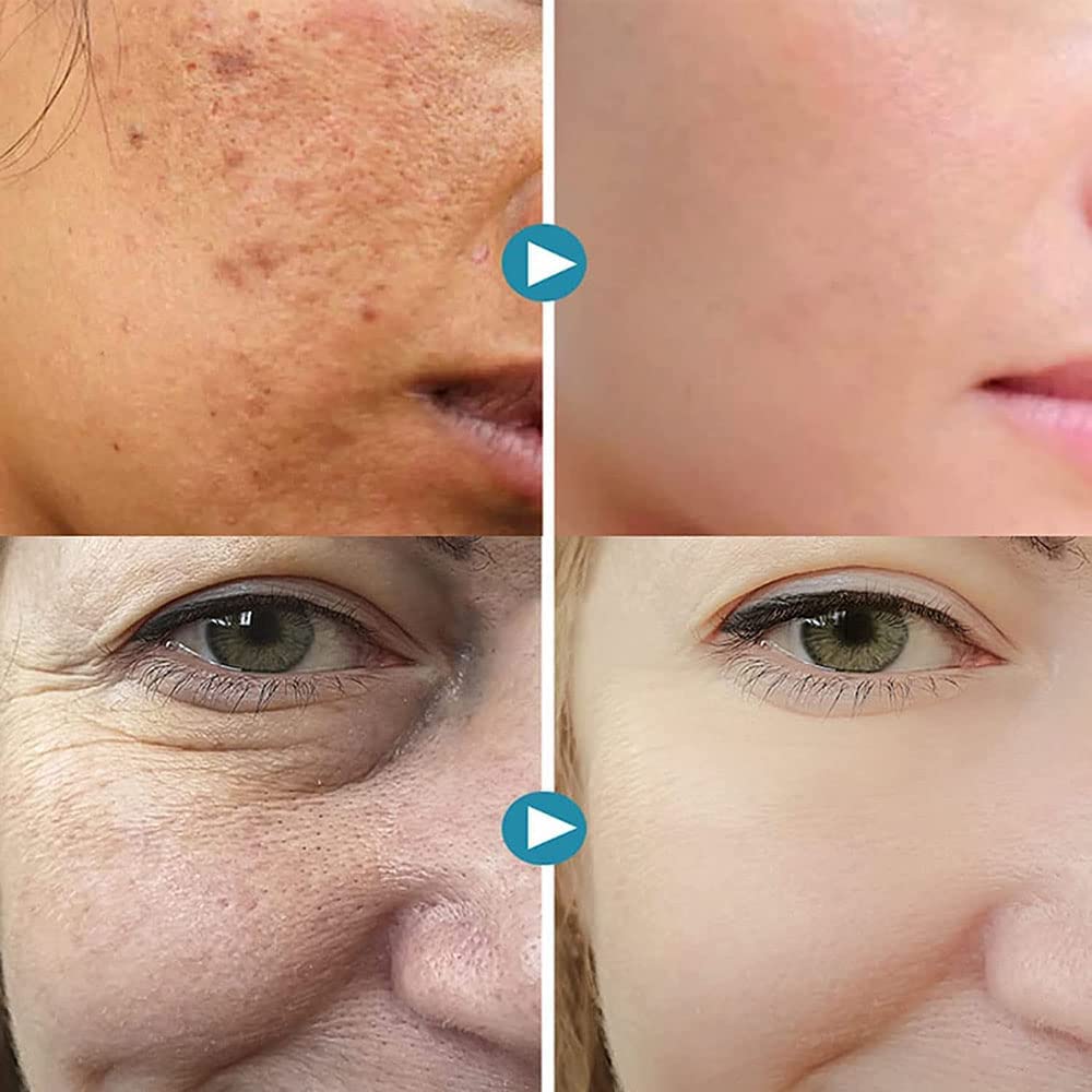 Magical Pore Eraser - LightsBetter