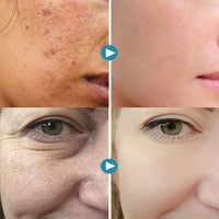 Thumbnail for Magical Pore Eraser - LightsBetter