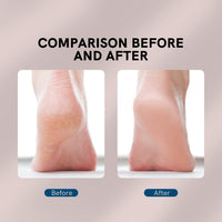 Thumbnail for Portable Electric Foot Grinder - LightsBetter