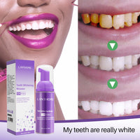 Thumbnail for Teeth Whitening - LightsBetter