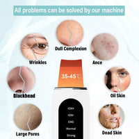 Thumbnail for Ultrasonic Skin Scrubber - LightsBetter