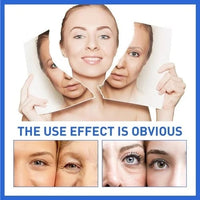 Thumbnail for Botox Face Serum - LightsBetter
