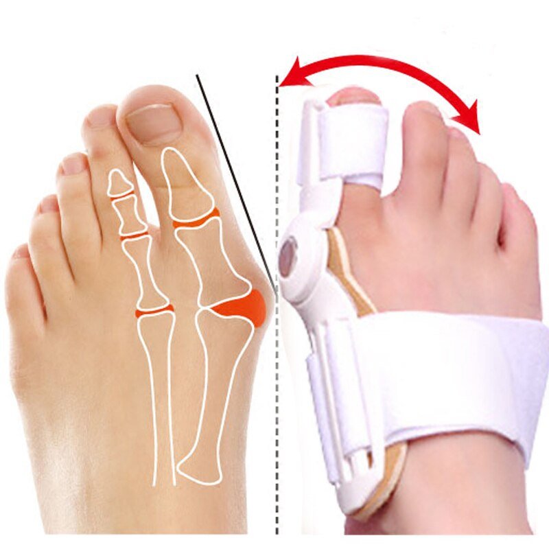 Bunion Corrector™ - LightsBetter