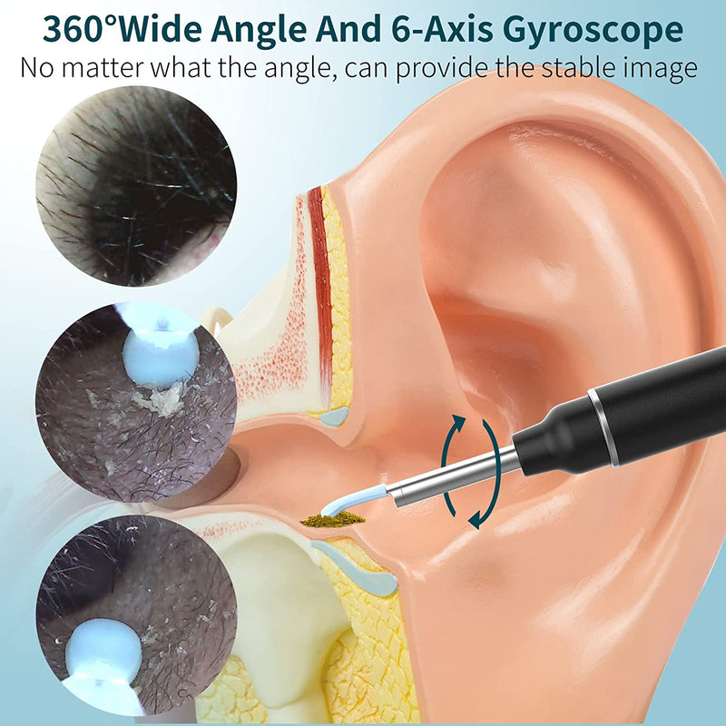 Earwax Cleaner with Camera - LightsBetter