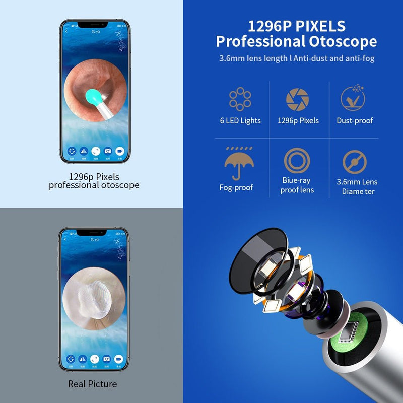Earwax Cleaner with Camera - LightsBetter