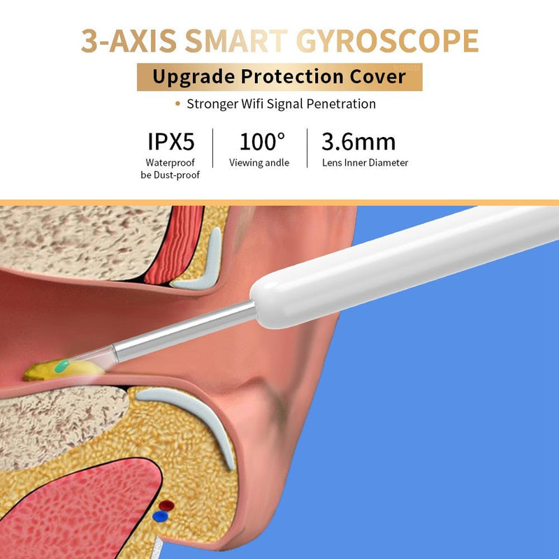 Earwax Cleaner with Camera - LightsBetter