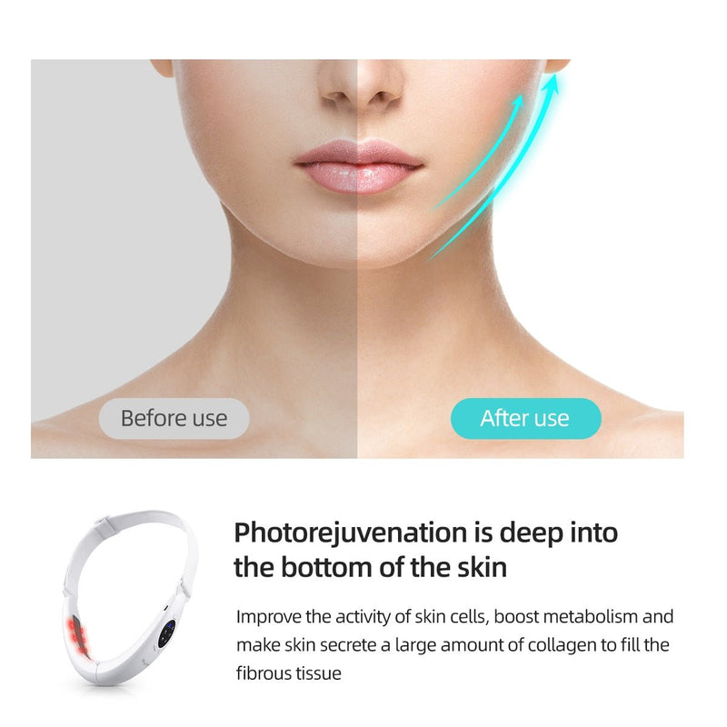 Microcurrent Wrinkle Remover - LightsBetter