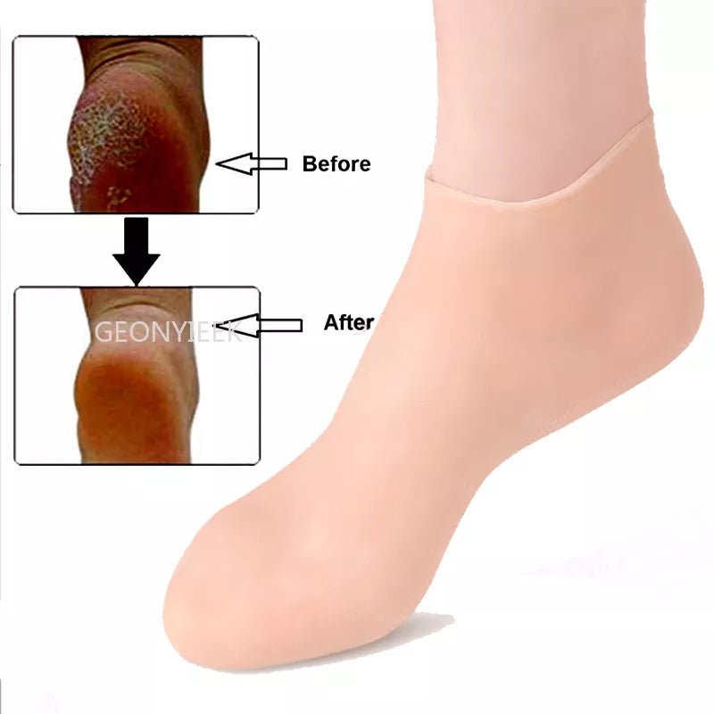 Moisturizing Gel Heel Socks - Cracked Foot Care – LightsBetter