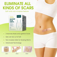 Thumbnail for Silicone Scar Sheets - LightsBetter