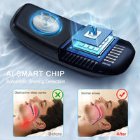 Thumbnail for Smart Anti Snoring Device - LightsBetter