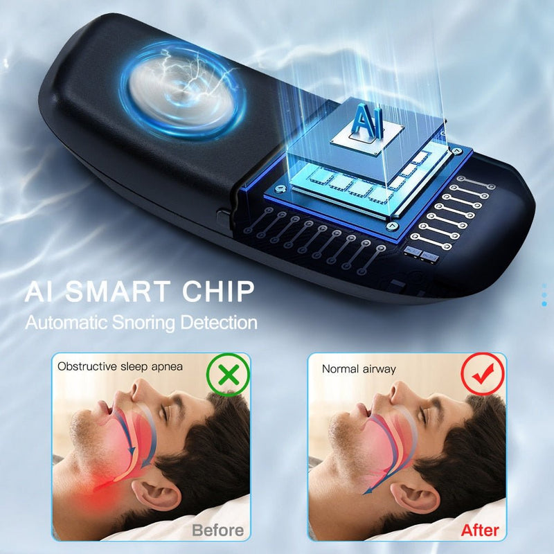 Smart Anti Snoring Device - LightsBetter