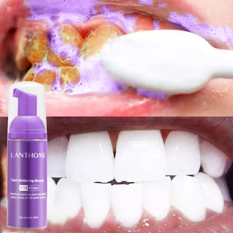 Teeth Whitening - LightsBetter