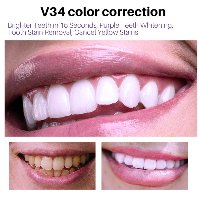 Teeth Whitening - LightsBetter