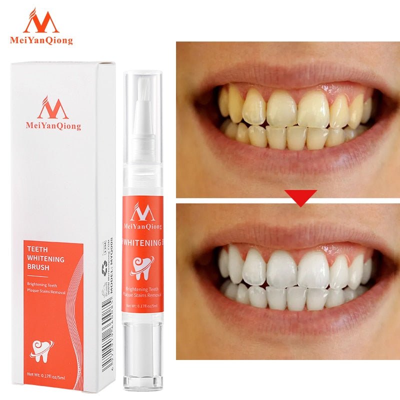 Teeth Whitening - LightsBetter