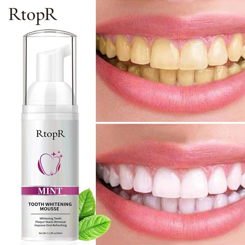 Teeth Whitening - LightsBetter