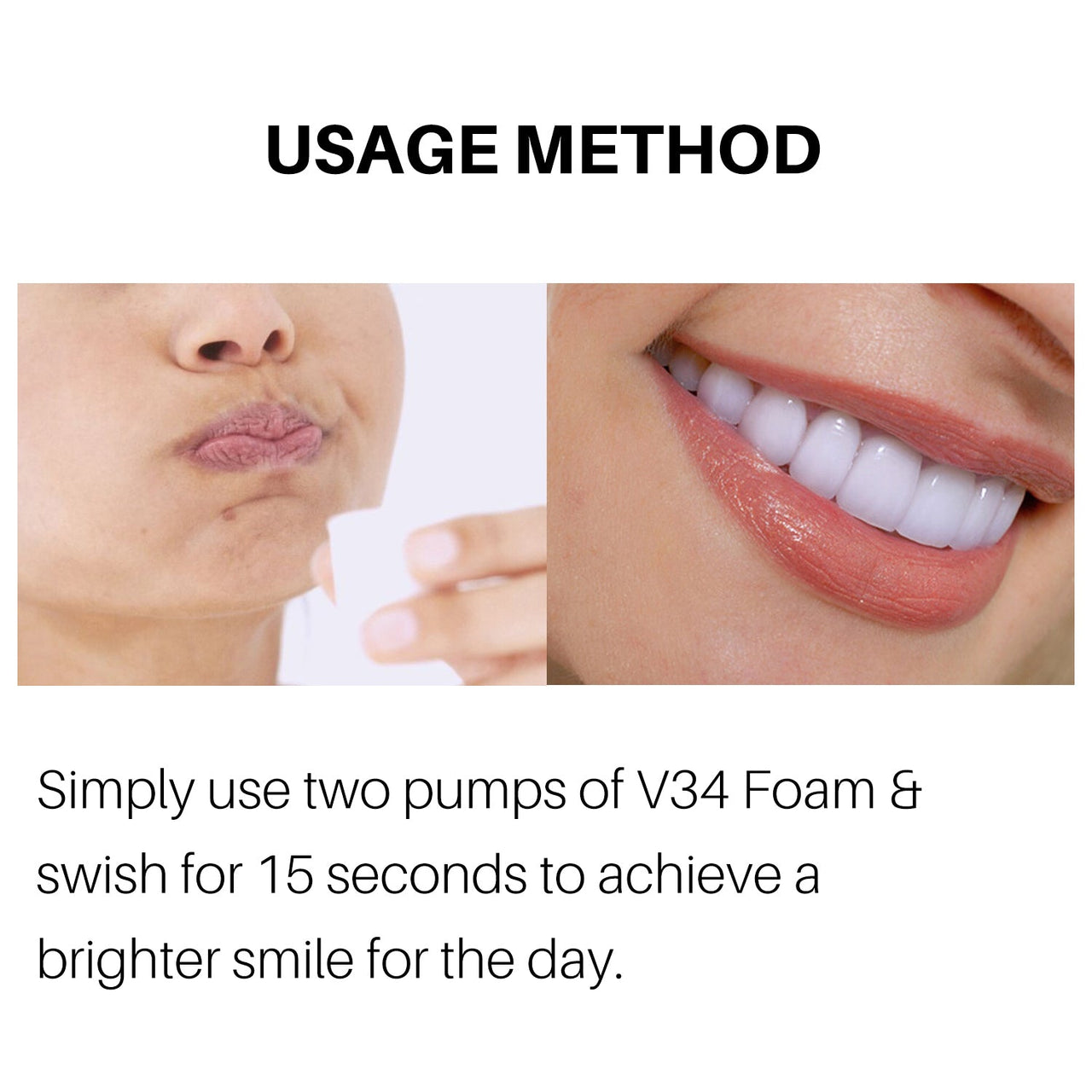 Teeth Whitening - LightsBetter