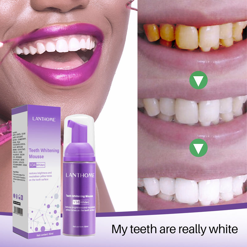 Teeth Whitening - LightsBetter