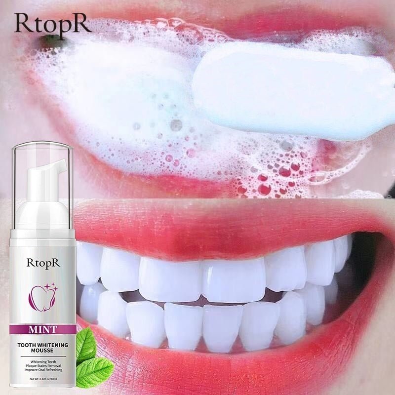 Teeth Whitening - LightsBetter