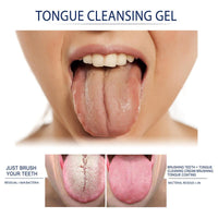 Thumbnail for Tongue Cleaner Kit - LightsBetter